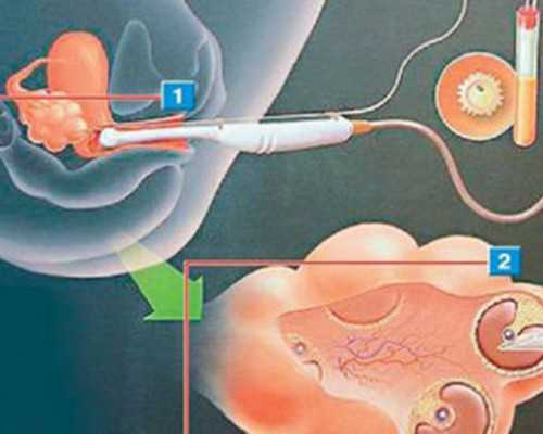 液压泵的分类方式很多按流量是否可调节分为_凉拌呛藕丁