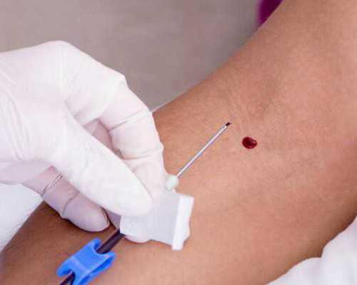 中介送香港验血受法律保护吗_香港验血胎胎芽7mm准吗_邮寄血过去可靠吗!