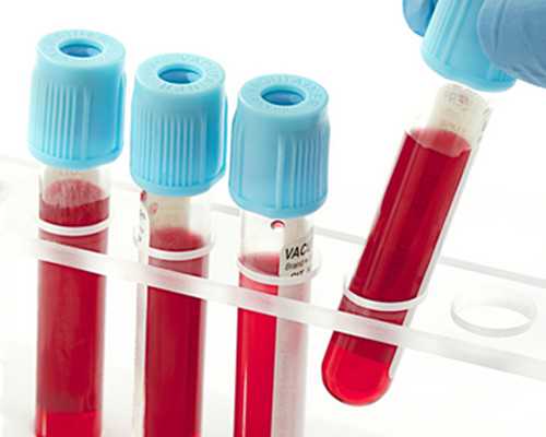 泵车图片大全_韩式血型瘦身法