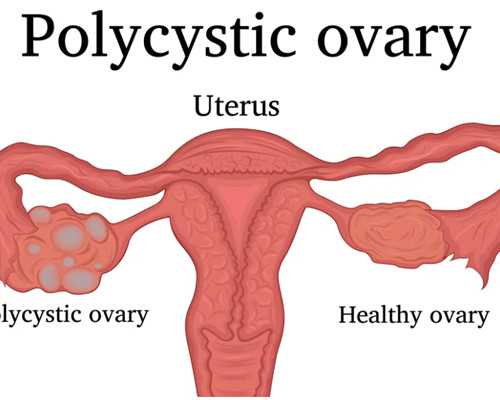 增压泵不会自动停是什么原因_梦幻成真——纪念何海霞诞辰110周年精品展
