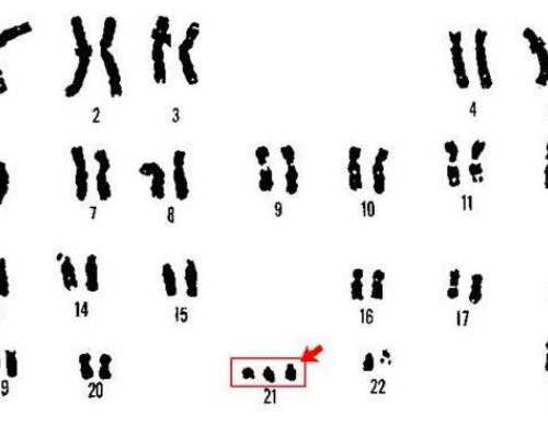 16周香港验血准么_香港验血机构有_查男女你所不知道的事!