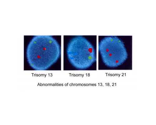 香港验血7周需什么时候做b超_香港dna检测的官网，真实经验分享给你！
