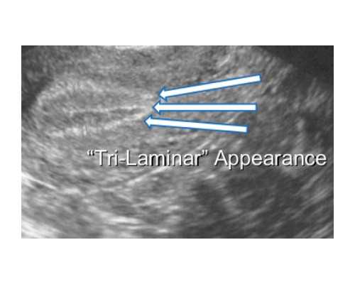 压滤机进料泵用什么类型的泵_徐健《三清图》清新出尘生气盎然
