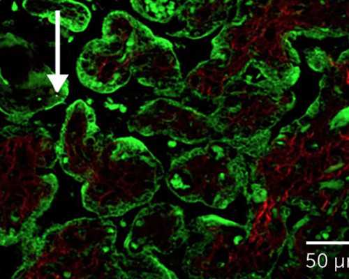 泵站的远程控制系统_男士怎么减肥推荐6道低热量减肥食谱