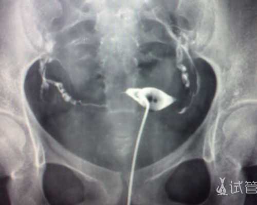 香港验血怀孕要多久出结果_香港验血男女条件_采血鉴定性别需要什么流程