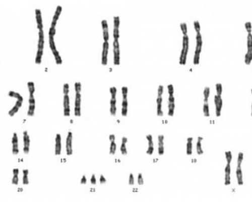 怀孕6个月还能香港验血_香港7周验血检测报告准不准,验血是女孩_能翻盘么