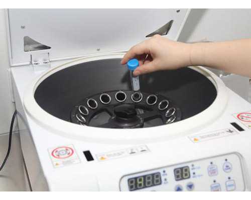 香港验血怎么快递过去_血样运输到香港查男女_验血查性别,实例分享!