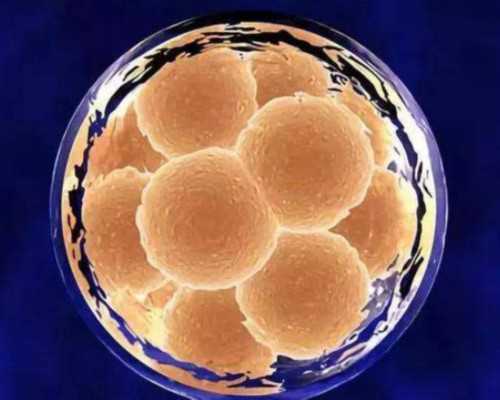 泵的类型及工作原理_中国当代艺术应回到原来应有的价格