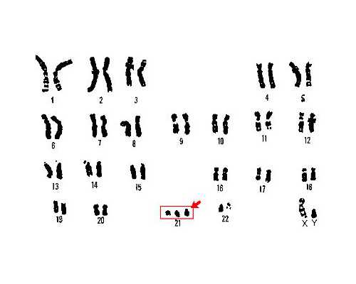 香港验血六周跟七周有区别吗_香港验血无结果_该如何预约希望可以帮到你!