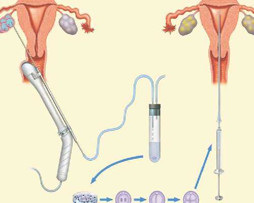 香港验血检测宝宝男女_我自己去孕妇去香港胎儿性别鉴定的全部过程