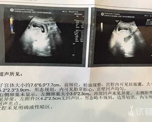 香港哪里有验血查男女_香港验血鉴定男女准吗几周验最准_多少周可以去怎么个