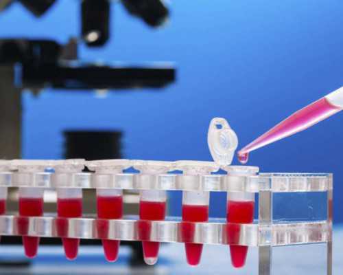 有邮寄香港验血的宝妈么_香港验血多少钱邮寄费用？想知道准不准关键的都在