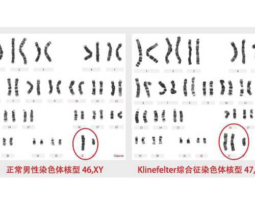 8周香港验血复查_怀孕几个月能测出男女_性别鉴定需要满足哪些条件