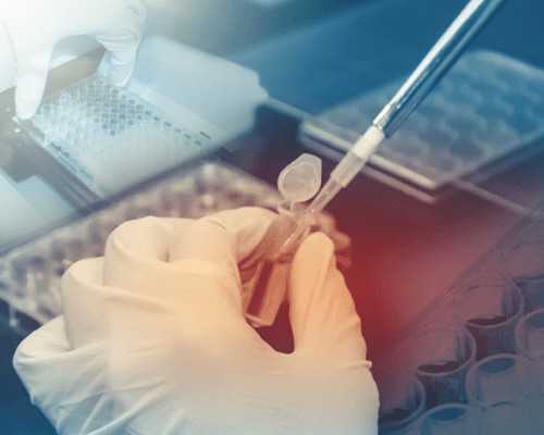 糖尿病需要弄什么泵_孕酮低跟精子有关系吗