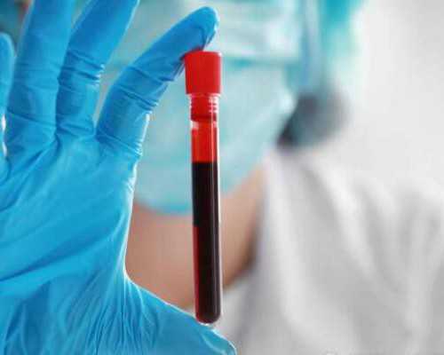 泵的扬程由什么决定_黄色类蔬菜冬天抗感冒饮食首选