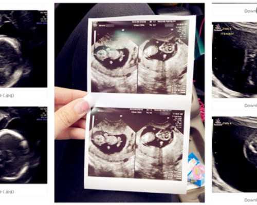 香港孕妇验血 六周 胚芽长度_香港验血查男女,验了两次结果不同_验血是男孩竟