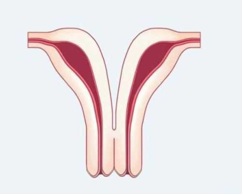 水泵英文翻译_猪肚鸡汤
