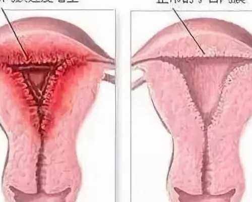 孕50天香港验血_香港任何医院都可以鉴定胎儿性别吗,专业香港验血诊所地址