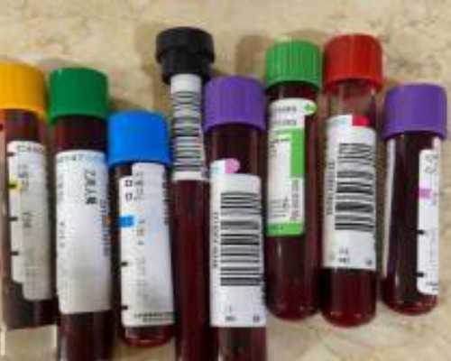 香港验血网站查询结果只有一般的_胎芽9mm香港验血真实吗?亲身经历告诉你