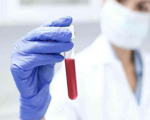 氮泵的作用与功效_藤田美术馆藏中国文物拍卖引发的思考