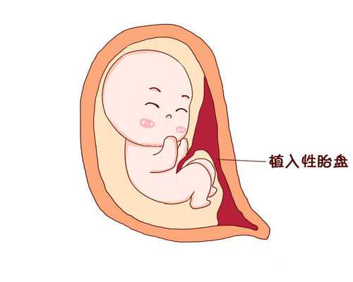 正弦泵工作原理动画_2015年红木家具行情冷清