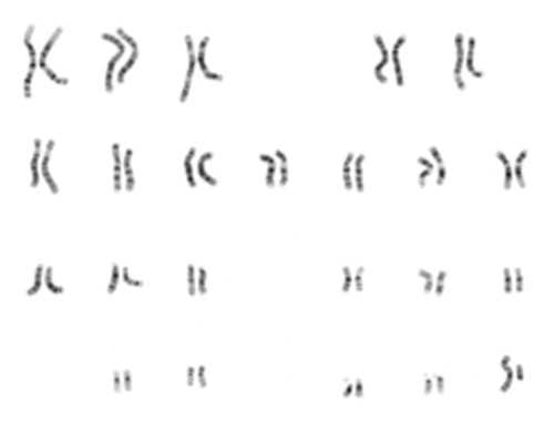 香港验血测胎儿性别几天出结果_在香港鉴别孩子性别合法吗?原来你不知道的还