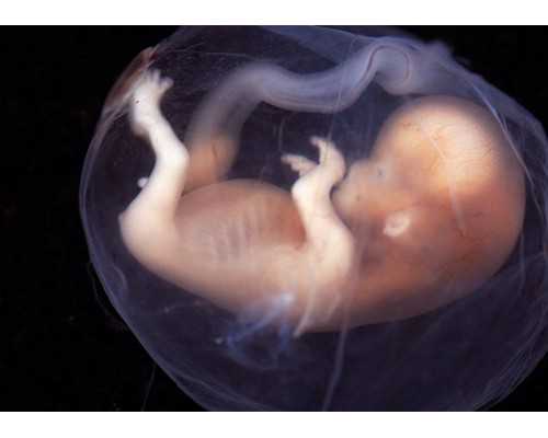 2026年邮寄香港验血_香港验血有没有不准的例子,性别鉴定是男孩会翻盘么