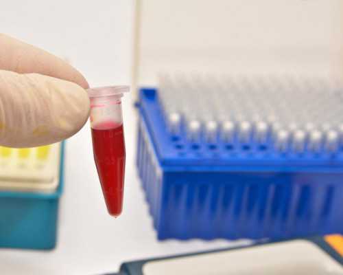 香港怀孕验血结果为阳性是男孩还是女孩_＂香港验血直通车,需要注意的都在这