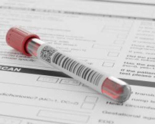 固瑞克气动柱塞泵_书画家王蔚波接受香港商报记者采访