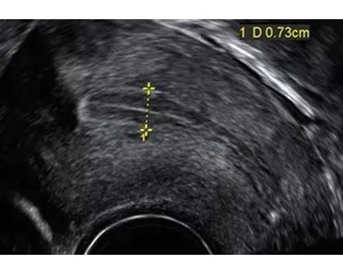 怀孕了香港验血的条件_去香港尖沙咀验血查男孩女孩准不准_有去香港验血翻盘