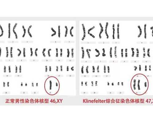 香港验血孕周怎么算_怀孕过香港验男女_预约鉴定性别哪家最权威!