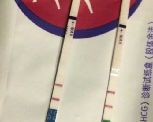 喷泉泵与潜水泵的区别_当罗马尚未建于世间:伊特鲁里亚文明展苏州开展