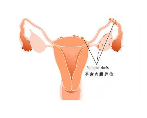 孕妇香港验血准吗_香港哪里验血多少钱啊_验血是男孩竟然翻盘!