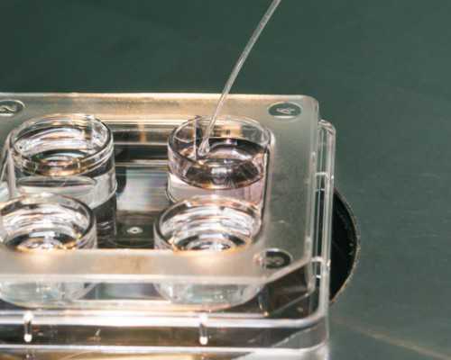 怀孕到香港验血准吗_香港验血准确率怎么，香港验血查男女会有禁绝的状况吗