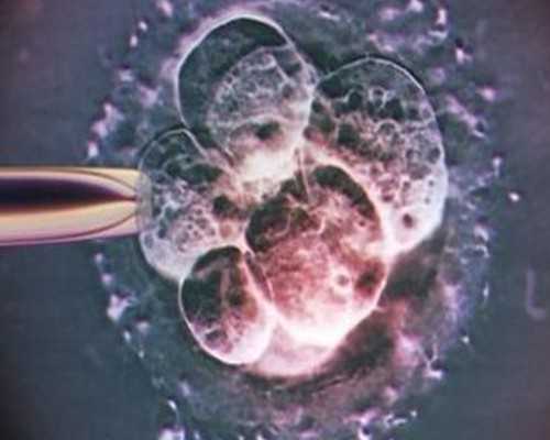 充气泵拼音怎么写_长期上火怎么吃降火药都没用