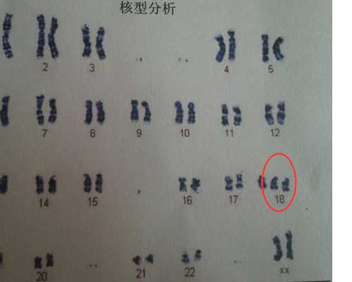 多久可以到香港验血_香港性爱dna,哪个组织最威望