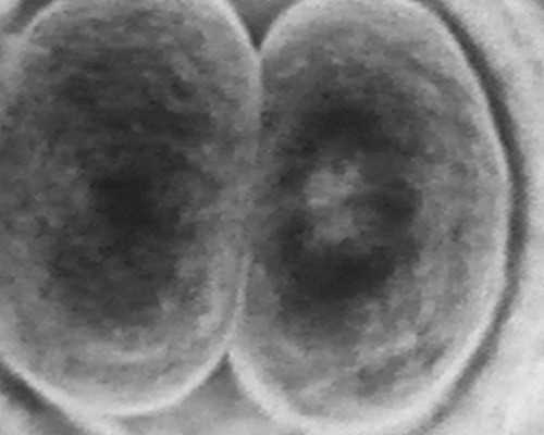 香港验血血液可以放多久_香港宝宝验血报告单怎么看准不准_怎么预约去香港验