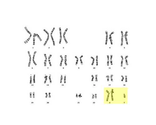 香港验血查性别多久能出结果_怀孕多少周可以香港验血查男女_结果真的哪么准