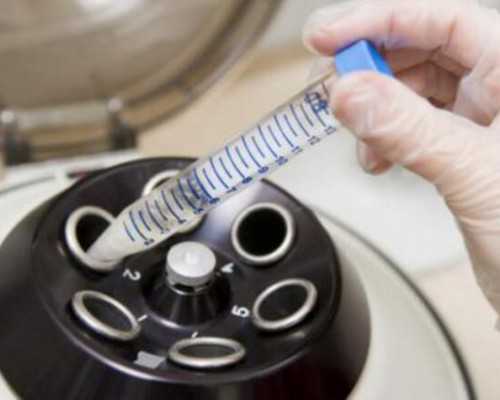 香港验血7天血会变质吗_怀孕多久可以抽血验男女香港多少钱_需要达到什么条件