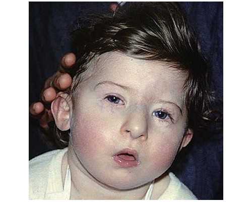 香港验血多少天知道结果_男女在一起多久会怀孕_需要预约吗具备什么条件