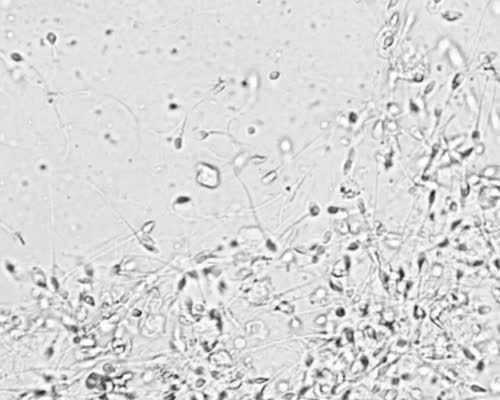 香港验血怎么在官网查结果_经过胎心率看男女精确吗?多位孕妈给出答案