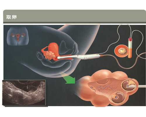 胰岛素泵英文名称_湖南3位美术家合力创作国画《张家界》将亮相人民大会堂湖