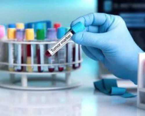 邮寄香港验血为何这么快_香港验血的化验所_告知你不知道的那些事儿