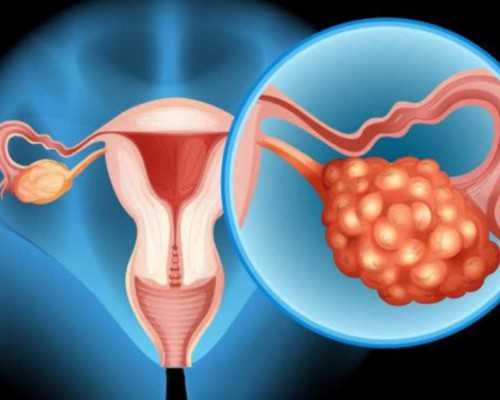 无阀柱塞泵_血檀和小叶紫檀特征极为相似 价格却相差数十倍