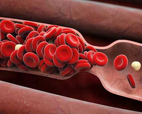 潜水泵英文翻译_艺术市场低谷期 投其所好更重要