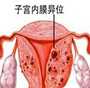 香港验血结果y染色体呈阳性_香港验血是女孩翻盘了DNA判定需求哪些条件