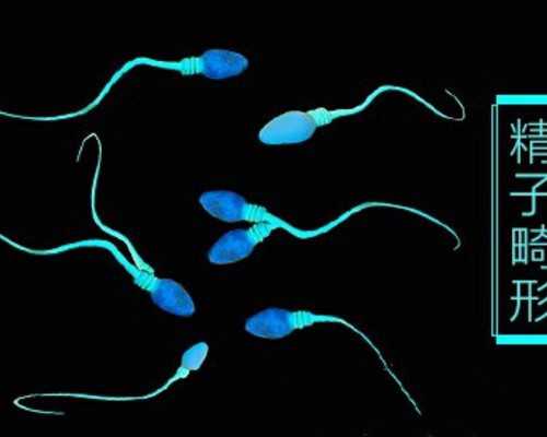 香港美亚验血地址_香港验血y染色筛查呈阳性_报告单Y染色体呈阳性就是男孩吗