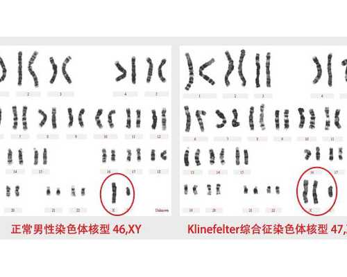 一体化预制泵站的使用有哪些好处_开拍国际7月下旬春拍，继续主打“有美”品