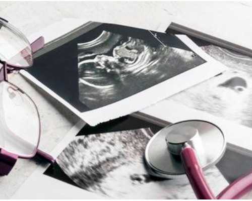 怀孕多少天香港可以验血_仿写爱莲说爱莲说 仿写