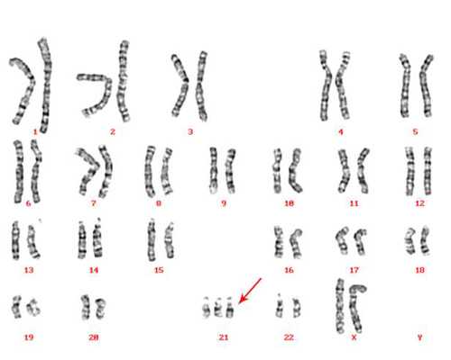 香港验血验男女准确率_神婆算男女和香港验血不一样_验血查男女真的靠谱吗